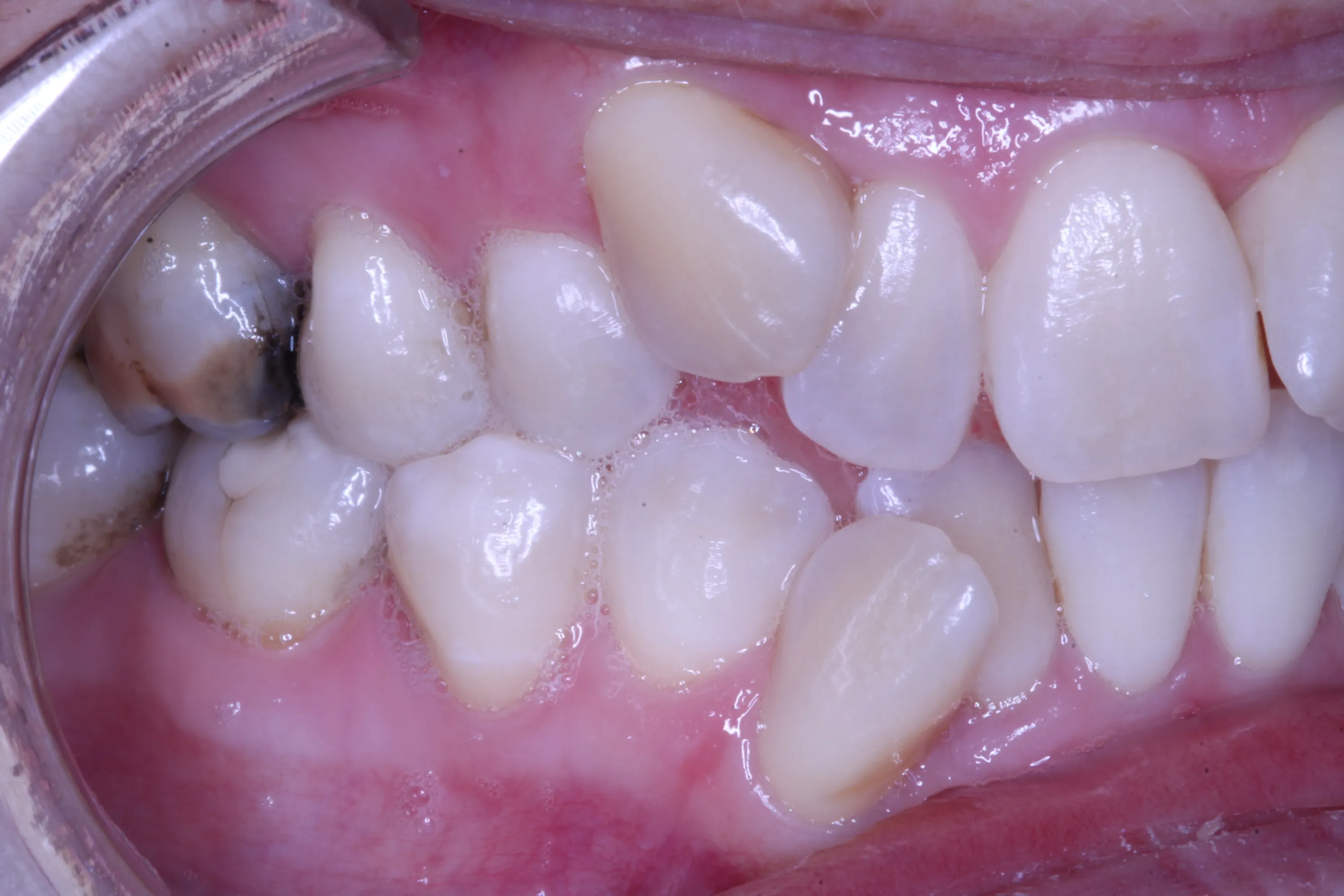 smile-gallery gallery